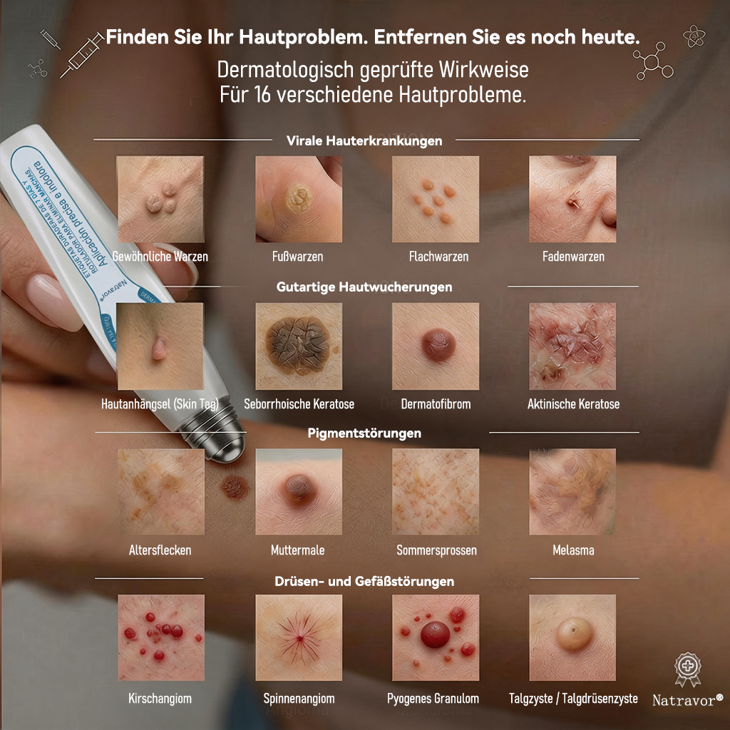 🎁🎁🎁 Erhalten Sie 30 % Rabatt auf das zweite Produkt!