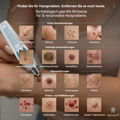 🎁🎁🎁 Erhalten Sie 30 % Rabatt auf das zweite Produkt!