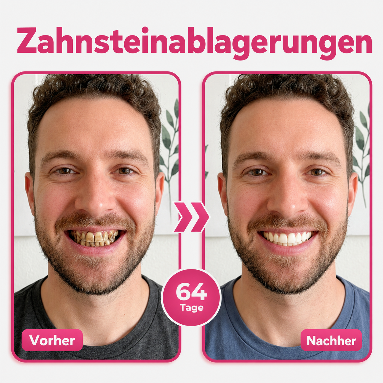 🦷Natravor® Thismile NH-10 Zahnpasta-Serum für Zahnschmelz und Zahnfleisch – Advanced Therapy