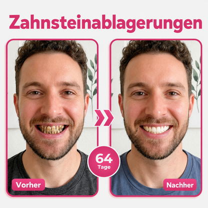 🦷Natravor® Thismile NH-10 Zahnpasta-Serum für Zahnschmelz und Zahnfleisch – Advanced Therapy