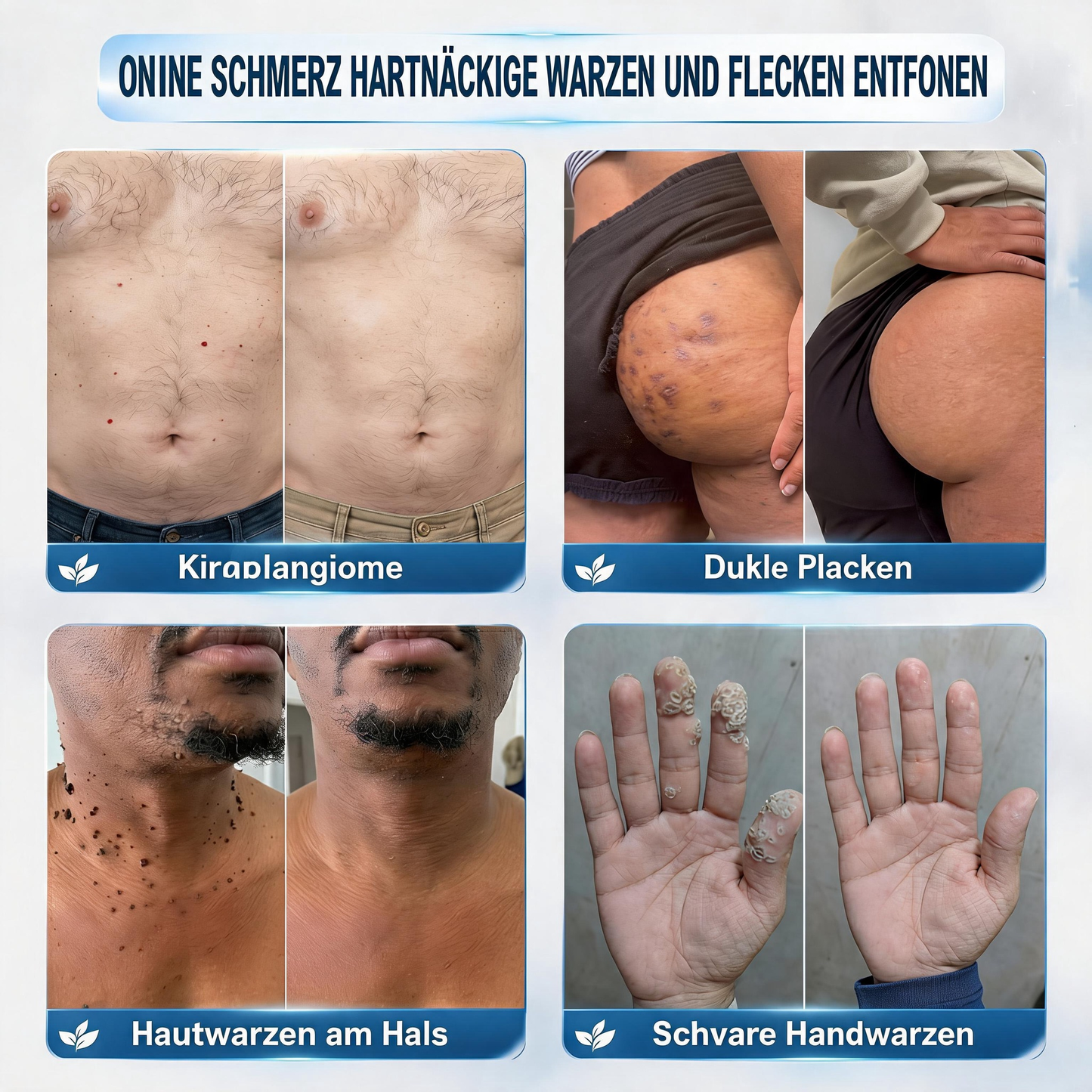🎁🎁🎁 Erhalten Sie 30 % Rabatt auf das zweite Produkt!