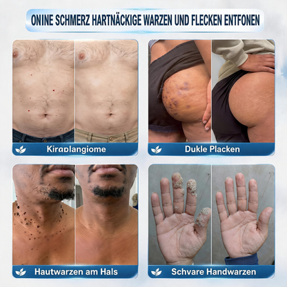 🎁🎁🎁 Erhalten Sie 30 % Rabatt auf das zweite Produkt!