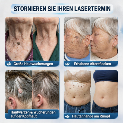 🎁🎁🎁 Erhalten Sie 30 % Rabatt auf das zweite Produkt!